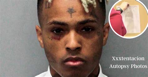 xxxtentacion autopsy photos leaked|Autopsyfiles.org 